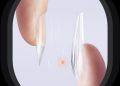 Five Angeles launches Tipex: A 500-Piece nail tip set to enhance efficiency and elevate services for nail professionals
